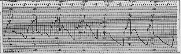Immagine: 2 - Esempio di tracciato tratto vedi Immagine 1 Esempio di tracciato tratto vedi Immagine 1